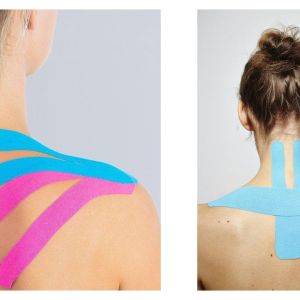 Aplicarea Benzilor Kinesiologice