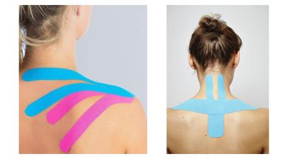 Aplicarea Benzilor Kinesiologice