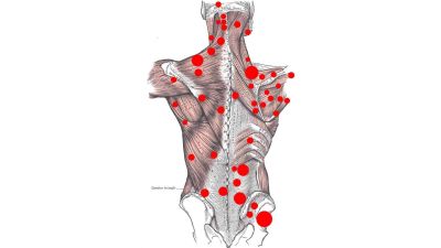 Masterclass Trigger Point Arad 