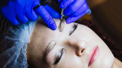 Curs Microneedling