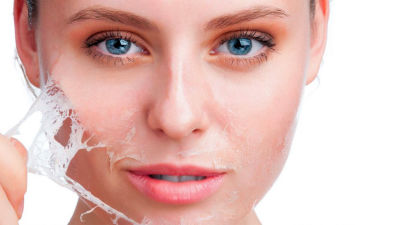 Peeling Chimic