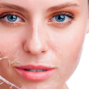 curs peeling brasov