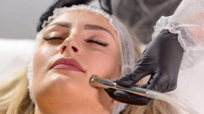 Dermato-Estetică non-invazivă - Microdermabraziune facială