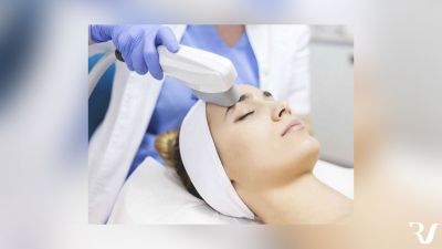 IPL Facial