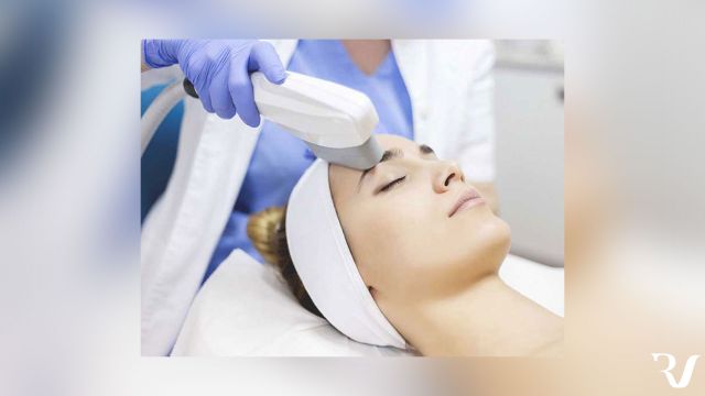 IPL Facial