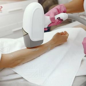 Epilare definitivă cu Laser și IPL