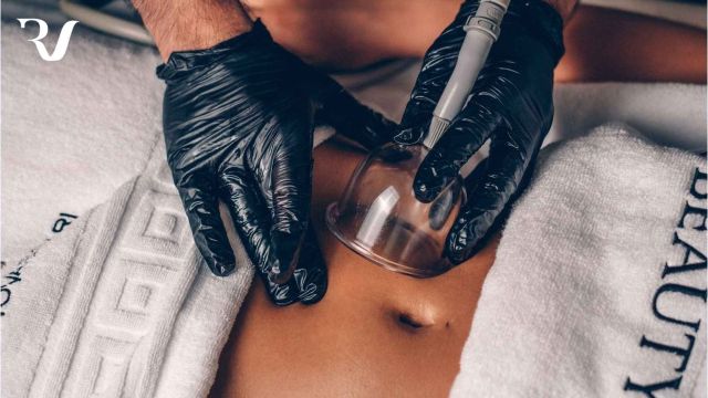 Remodelare Corporală